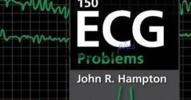 150 ECG Problems 4th Edition PDF Free Download