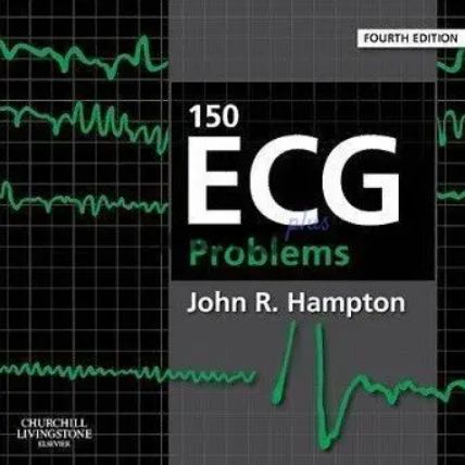 150 ECG Problems 4th Edition PDF Free Download