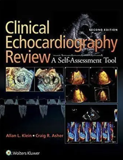 Clinical Echocardiography 2nd Edition PDF Free Download