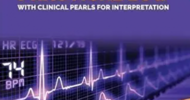 Practical ECG A Review Book PDF Free Download