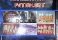 Contemporary Oral and Maxillofacial Pathology PDF Free Download