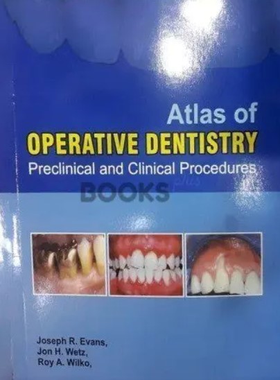 Atlas of Operative Dentistry PDF Free Download