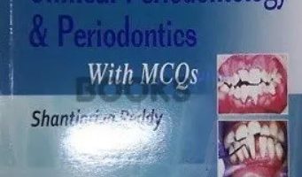 Essentials of Clinical Periodontology & Periodontics PDF Free Download