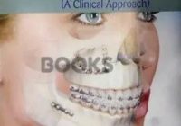 Killeys Fracture of the Mandible PDF Free Download