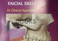 Killeys Fracture of the Middle Third of the Facial Skeleton PDF Free Download