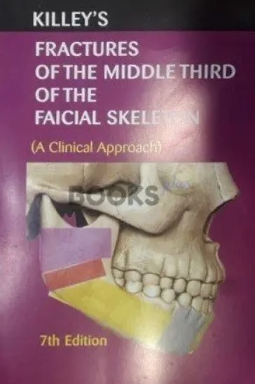 Killeys Fracture of the Middle Third of the Facial Skeleton PDF Free Download