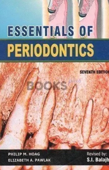 Essentials of Periodontics PDF Free Download
