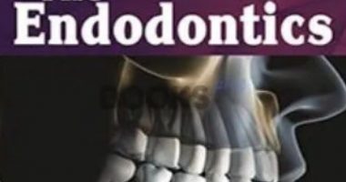 The Endodontics by Muhammad Pervaiz Iqbal PDF Free Download