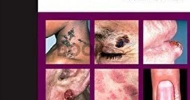 Atlas of Clinical Dermatology 4th Edition PDF Free Download