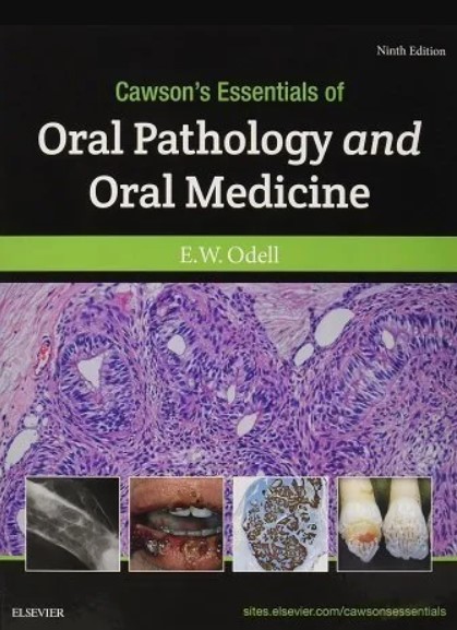 Cawson’s Essentials of Oral Pathology and Oral Medicine 9th Edition PDF Free Download