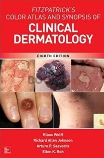 Fitzpatrick’s Color Atlas and Synopsis of Clinical Dermatology 8th Edition PDF Free Download
