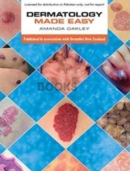 Dermatology Made Easy by Amanda Oakley PDF Free Download